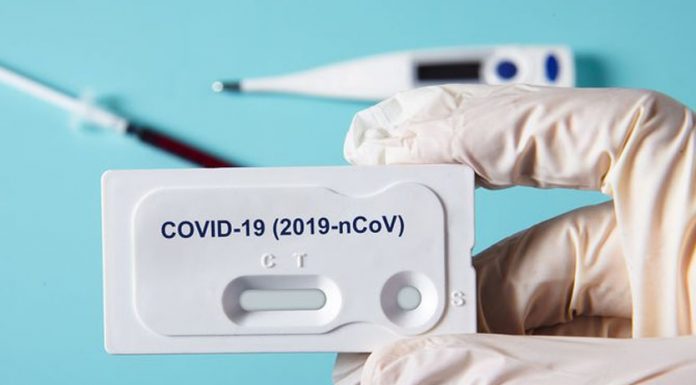 Warga Yang Hadiri Konser Rhoma Irama Menjalani Tes Rapid Covid-19